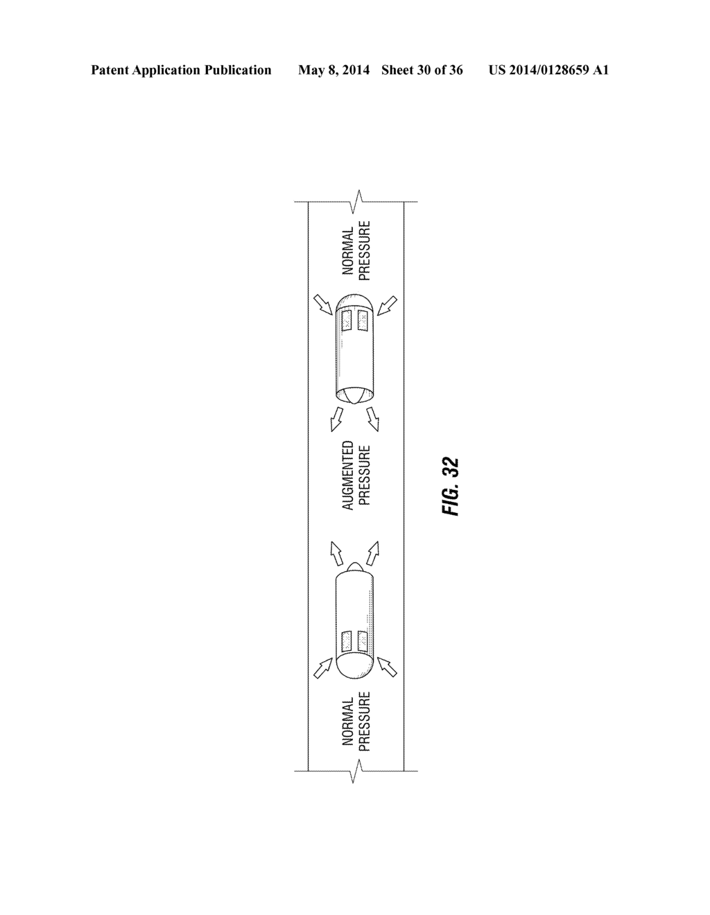 SYSTEMS AND METHODS FOR FLUID FLOWS AND/OR PRESSURES FOR CIRCULATION AND     PERFUSION ENHANCEMENT - diagram, schematic, and image 31