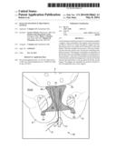 MALE INCONTINENCE TREATMENT SYSTEM diagram and image