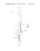 MALE INCONTINENCE TREATMENT SYSTEM diagram and image