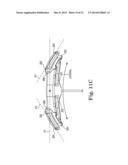 MALE INCONTINENCE TREATMENT SYSTEM diagram and image