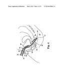 ADJUSTABLE TENSION INCONTINENCE SLING ASSEMBLIES diagram and image