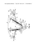 ADJUSTABLE TENSION INCONTINENCE SLING ASSEMBLIES diagram and image