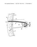 ADJUSTABLE TENSION INCONTINENCE SLING ASSEMBLIES diagram and image