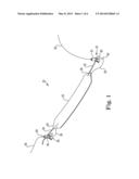 INCONTINENCE TREATMENT DEVICE INCLUDING NON-POROUS SUB-URETHRAL SLING diagram and image