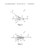 INCONTINENCE TREATMENT DEVICE INCLUDING NON-POROUS SUB-URETHRAL SLING diagram and image