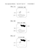 FLUORESCENCE ENDOSCOPE APPARATUS diagram and image