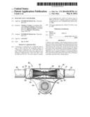 DIALYSIS VALVE AND METHOD diagram and image