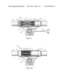 DIALYSIS VALVE AND METHOD diagram and image