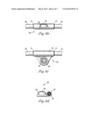 DIALYSIS VALVE AND METHOD diagram and image