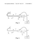 DEVICES, SYSTEMS, AND METHODS FOR DELIVERING FLUID TO TISSUE diagram and image