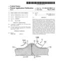 Force Modulating Tissue Bridge diagram and image