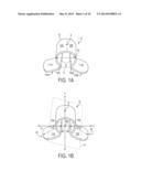 Force Modulating Tissue Bridge diagram and image