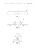 Force Modulating Tissue Bridge diagram and image