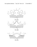 Force Modulating Tissue Bridge diagram and image