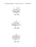 Force Modulating Tissue Bridge diagram and image