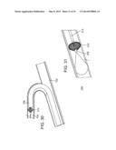 DEPLOYMENT MECHANISM FOR BODY VESSEL INSERTION DEVICES diagram and image