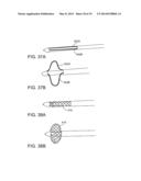 DEPLOYMENT MECHANISM FOR BODY VESSEL INSERTION DEVICES diagram and image