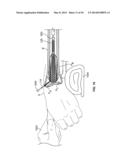 APPARATUS AND METHODS FOR FRACTURE REPAIR diagram and image