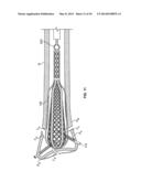 APPARATUS AND METHODS FOR FRACTURE REPAIR diagram and image