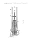 APPARATUS AND METHODS FOR FRACTURE REPAIR diagram and image