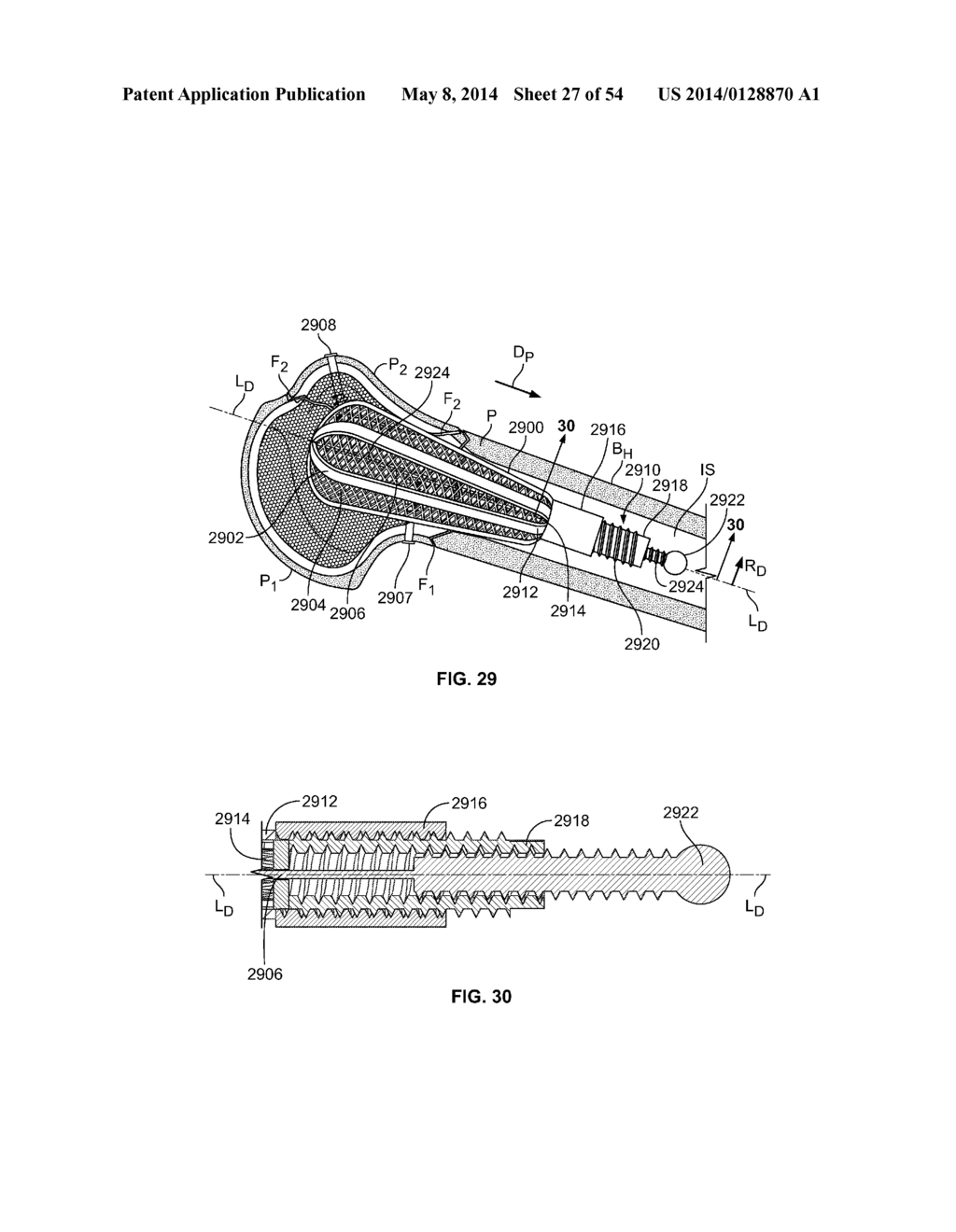 APPARATUS AND METHODS FOR FRACTURE REPAIR - diagram, schematic, and image 28