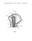 APPARATUS AND METHODS FOR FRACTURE REPAIR diagram and image