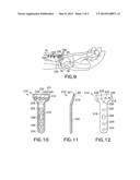 Volar Fixation System with Fixed-Angle Multi-Hole Drill Guide diagram and image