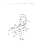 UNICOMPARTMENTAL CUSTOMIZED ARTHROPLASTY CUTTING JIGS diagram and image