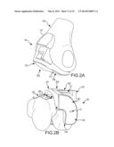 UNICOMPARTMENTAL CUSTOMIZED ARTHROPLASTY CUTTING JIGS diagram and image