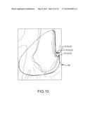 UNICOMPARTMENTAL CUSTOMIZED ARTHROPLASTY CUTTING JIGS diagram and image