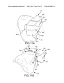 UNICOMPARTMENTAL CUSTOMIZED ARTHROPLASTY CUTTING JIGS diagram and image