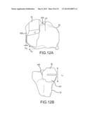 UNICOMPARTMENTAL CUSTOMIZED ARTHROPLASTY CUTTING JIGS diagram and image