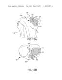 UNICOMPARTMENTAL CUSTOMIZED ARTHROPLASTY CUTTING JIGS diagram and image