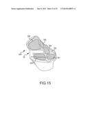 UNICOMPARTMENTAL CUSTOMIZED ARTHROPLASTY CUTTING JIGS diagram and image