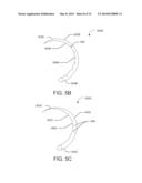 MEDICAL DEVICE AND RELATED METHODS OF USE diagram and image