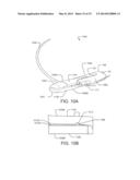 MEDICAL DEVICE AND RELATED METHODS OF USE diagram and image