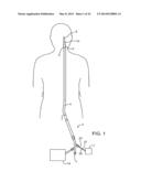 SYSTEMS, METHODS AND DEVICES FOR REMOVING OBSTRUCTIONS FROM A BLOOD VESSEL diagram and image