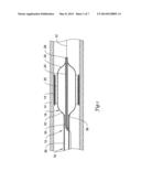 CUTTING BALLOON CATHETER HAVING FLEXIBLE ATHEROTOMES diagram and image