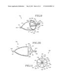 REMOVABLE ANCHORED LUNG VOLUME REDUCTION DEVICES AND METHODS diagram and image