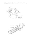 REMOVABLE ANCHORED LUNG VOLUME REDUCTION DEVICES AND METHODS diagram and image