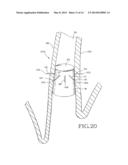 REMOVABLE ANCHORED LUNG VOLUME REDUCTION DEVICES AND METHODS diagram and image