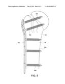 BONE PLATE WITH SUTURE HOLES FOR SOFT TISSUE REATTACHMENTS ON THE     DIAPHYSEAL REGION OF THE PLATE diagram and image