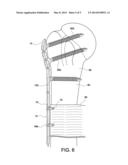 BONE PLATE WITH SUTURE HOLES FOR SOFT TISSUE REATTACHMENTS ON THE     DIAPHYSEAL REGION OF THE PLATE diagram and image