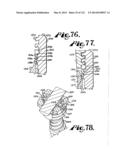 POLYAXIAL BONE ANCHOR WITH NON-PIVOTABLE RETAINER AND POP-ON SHANK, SOME     WITH FRICTION FIT diagram and image