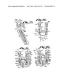 POLYAXIAL BONE ANCHOR WITH NON-PIVOTABLE RETAINER AND POP-ON SHANK, SOME     WITH FRICTION FIT diagram and image