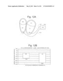 Cardiac Stimulation Apparatus And Method For The Control Of Hypertension diagram and image