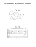 Cardiac Stimulation Apparatus And Method For The Control Of Hypertension diagram and image