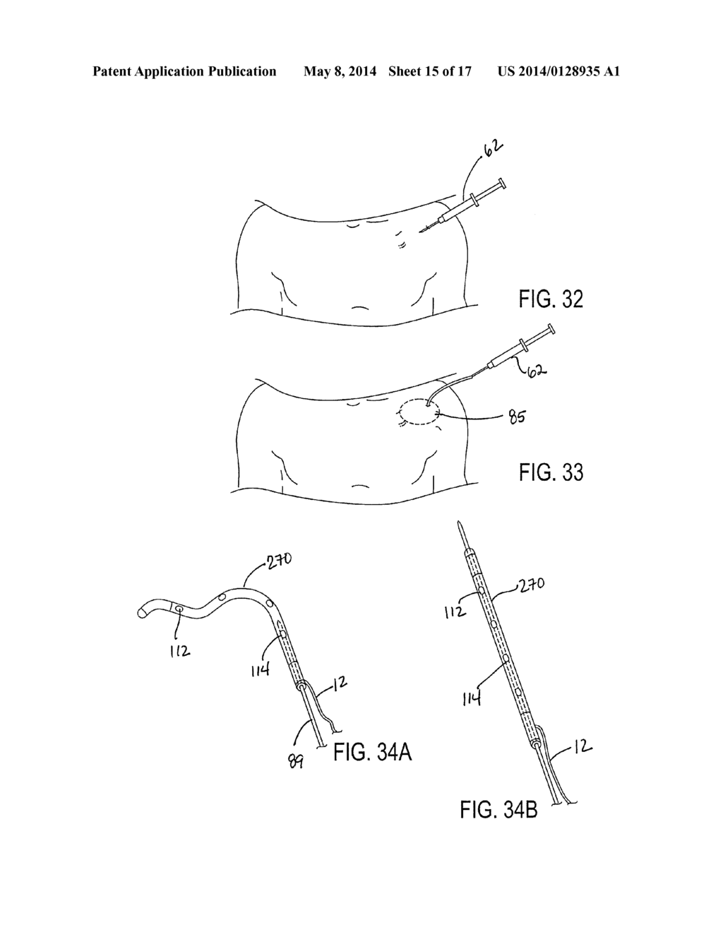 IMPLANTED CARDIAC DEVICE FOR DEFIBRILLATION - diagram, schematic, and image 16