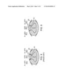 SYSTEM AND METHOD FOR INCREASING RELATIVE INTENSITY BETWEEN CATHODES AND     ANODES OF NEUROSTIMULATION SYSTEM diagram and image