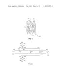 Biodegradable stent with enhanced fracture toughness diagram and image